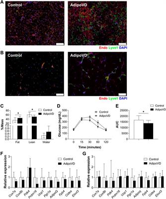 Increased adipose tissue lymphatic vessel density inhibits thermogenesis through elevated neurotensin levels